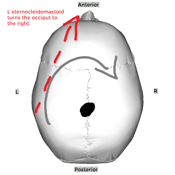 Contralateral rotation