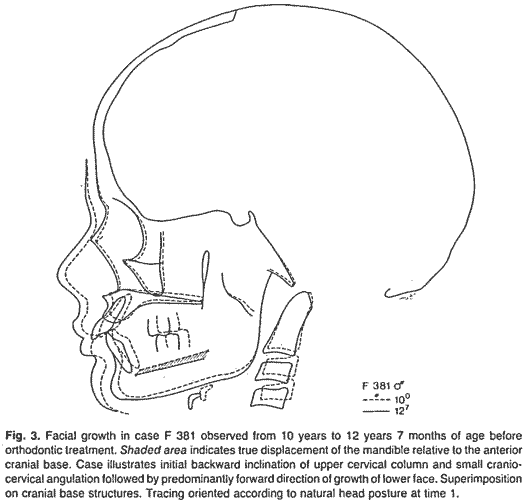 Fig 3 from Solow and Siersbk Nielsen, 1992