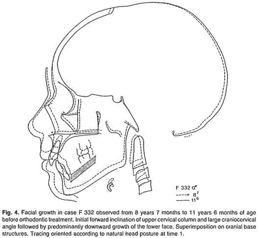 Fig 4 from Solow and Siersbk Nielsen, 1992