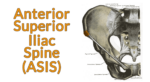 Drawing of the pelvis with the anterior superior iliac spine highlighted