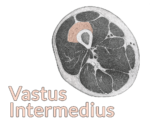 Drawing of a cross section of the thigh with the vastus lateralis highlighted
