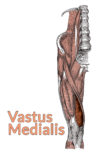 Drawing of the lumbar spine down to the top of the tibia with the vastus medialis highlighted