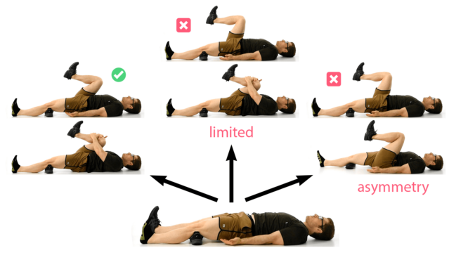 Supine march test showing a good result with full range of motion, one bad result with limited range of motion, and another bad result with asymmetry