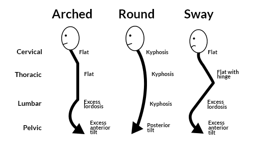 A comparison of normal, flat, and reversed spinal curves. An arched back has a flat cervical spine, flat thoracic spine, excess lumbar lordosis, and excess anterior pelvic tilt. A round back is kyphotic throughout each segment. A sway back is a cervical flattening with hyperlordosis at the base of the skull, a flattening of the thoracic spine with a hinge in the mid-back, excess lumbar lordosis, and excess anterior pelvic tilt